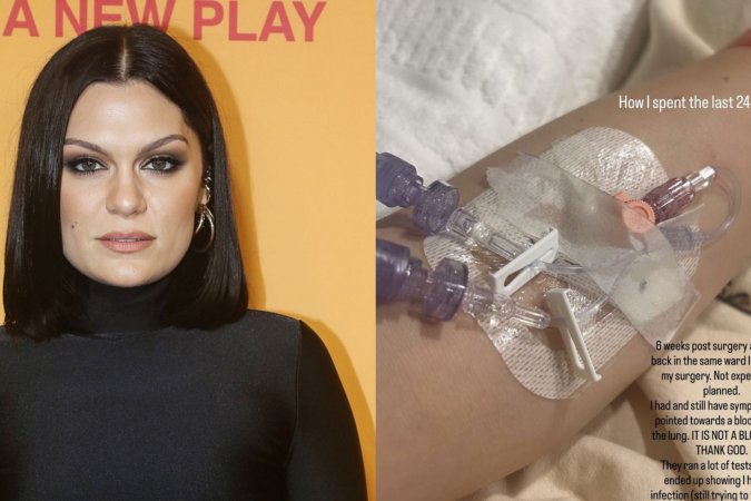 Jessie J -  (crédito: Reprodução/Instagram)