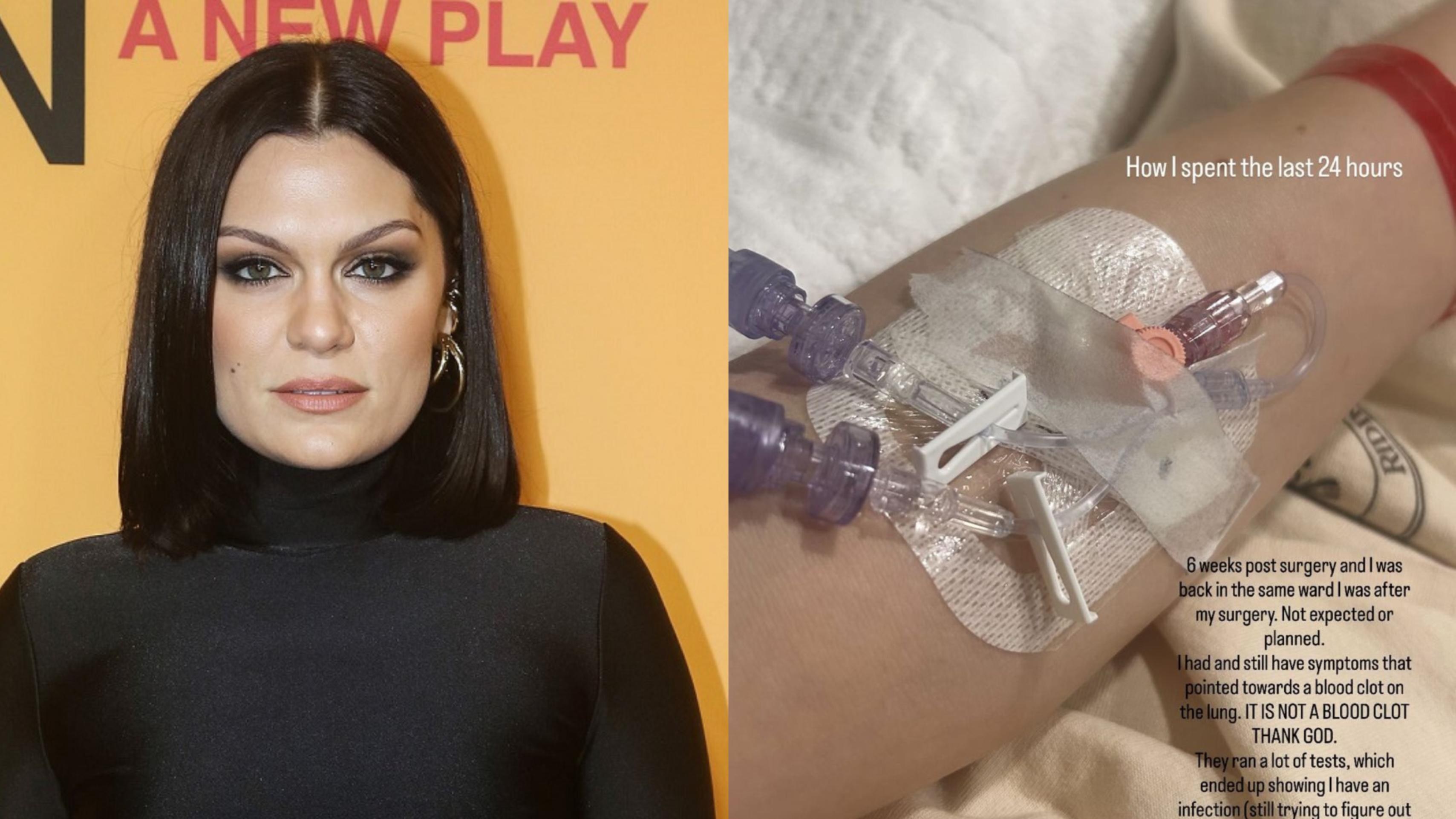 Jessie J é internada às pressas após infecção grave nos pulmões