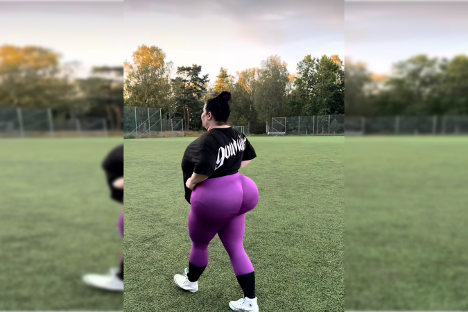 Natasha já passou por cinco procedimentos do tipo Brazilian Butt Lift (BBL) - (crédito: Reprodução/Instagram) Natasha já passou por cinco procedimentos do tipo Brazilian Butt Lift (BBL) - (crédito: Reprodução/Instagram)