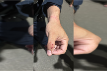 Policial ficou ferido após ataque ataque dos cachorros -  (crédito: PMDF/Divulgação)