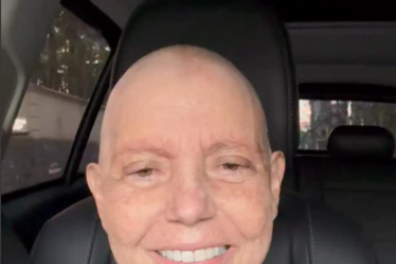 Filha do ex-presidente José Sarney, a deputada têm recebido apoio de seguidores e outros políticos durante o tratamento -  (crédito: Reprodução Instagram) -Filha do ex-presidente José Sarney, a deputada têm recebido apoio de seguidores e outros políticos durante o tratamento -  (crédito: Reprodução Instagram)