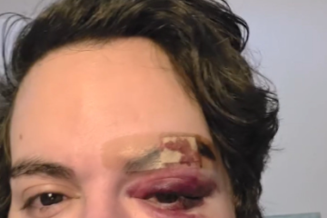 O agressor foi preso em flagrante por lesão corporal, racismo (por homotransfobia) e violação de domicílio - (crédito: Reprodução Redes Sociais) O agressor foi preso em flagrante por lesão corporal, racismo (por homotransfobia) e violação de domicílio - (crédito: Reprodução Redes Sociais)