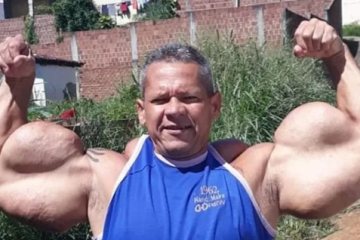 O pernambucano Arlindo de Souza, conhecido como 'Popeye Brasileiro' - (crédito: Reprodução/Facebook / @arlindoanomalia) O pernambucano Arlindo de Souza, conhecido como 'Popeye Brasileiro' - (crédito: Reprodução/Facebook / @arlindoanomalia)