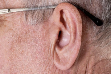 Sinal de Frank pode ser indício de problema cardíaco? -  (crédito: Reprodução/Google)