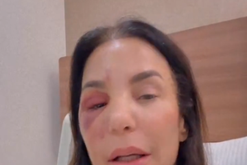 Ivete disse que está bem se recuperando -  (crédito: Reprodução / Instagram / @ivetesangalo)