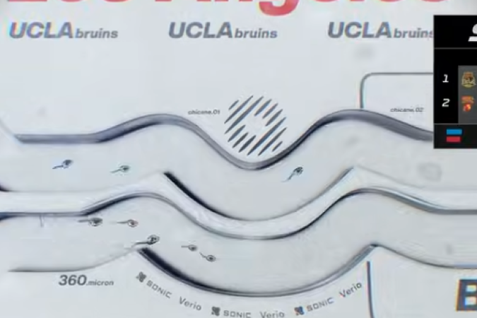 A competição consiste em uma pista de corrida microscópica que imita o sistema reprodutivo feminino - (crédito: Reprodução/ Spermracing) A competição consiste em uma pista de corrida microscópica que imita o sistema reprodutivo feminino - (crédito: Reprodução/ Spermracing)