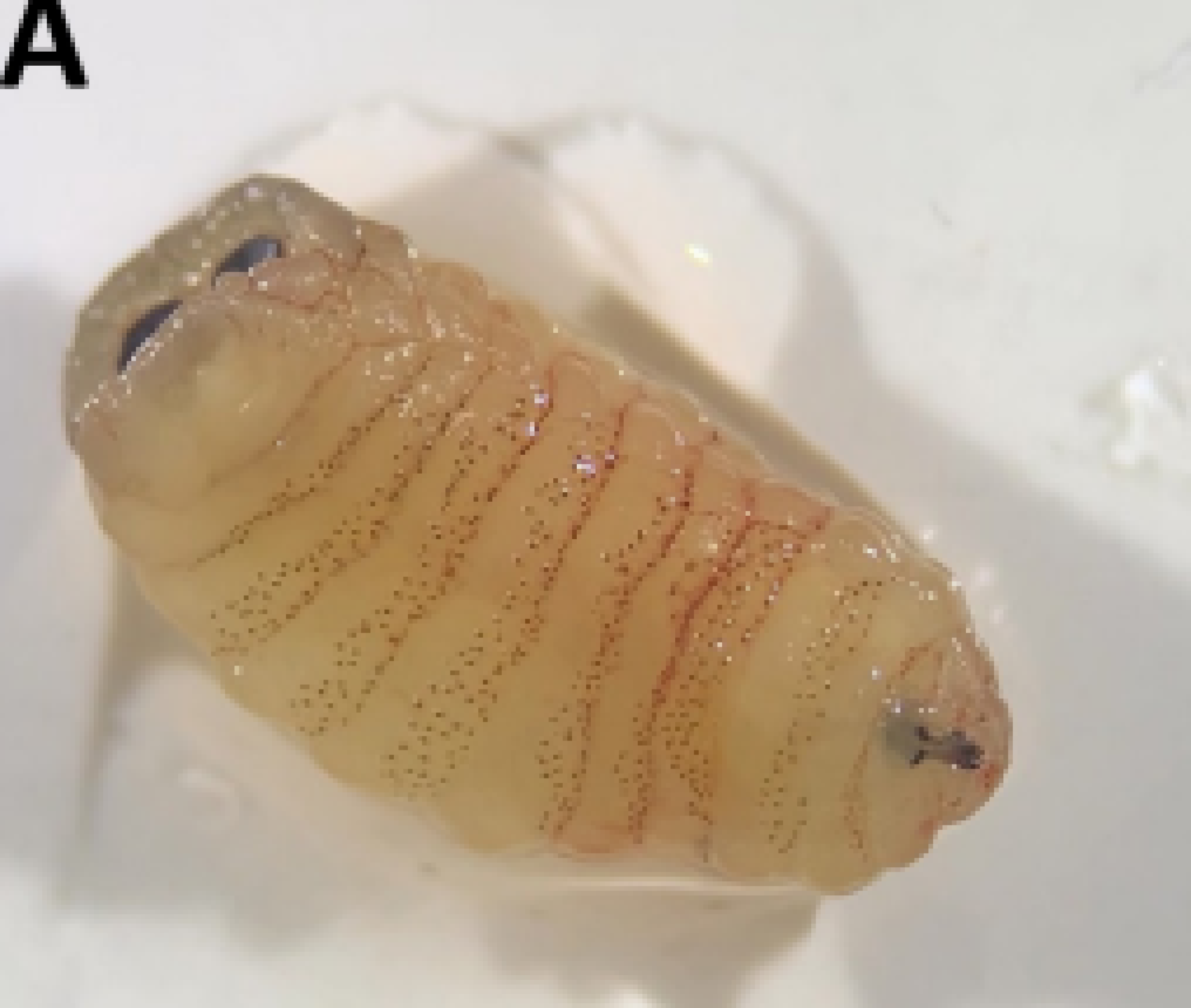 Mulher espirra larvas de mosca pelo nariz após sentir fortes dores no rosto