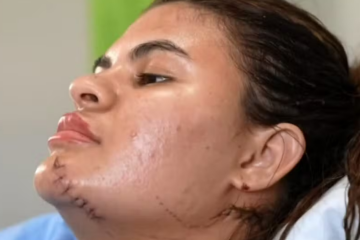Ana Calra teve inúmeros ferimentos graves nas pernas, braços, costas, rosto e pescoço -  (crédito: Reprodução / TV Globo)