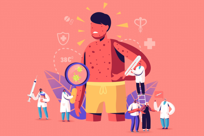 Febre alta, manchas vermelhas pelo corpo e conjuntivite estão entre os principais sintomas do sarampo (Imagem: ivector | Shutterstock) - (crédito: EdiCase) Febre alta, manchas vermelhas pelo corpo e conjuntivite estão entre os principais sintomas do sarampo (Imagem: ivector | Shutterstock) - (crédito: EdiCase)