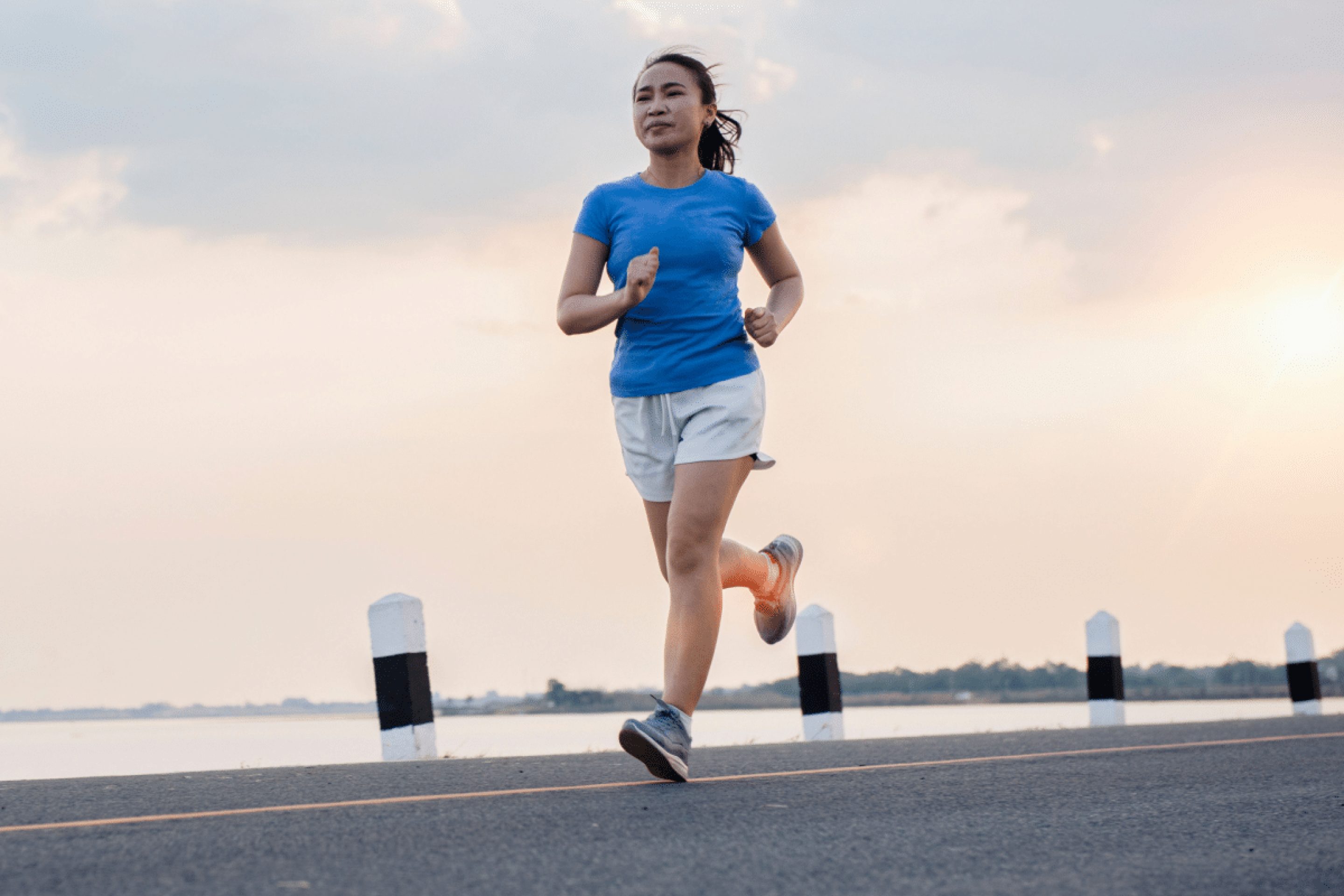 Corrida e lipedema: descubra quando a atividade pode ajudar ou piorar os sintomas