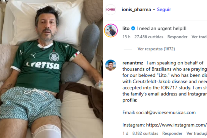 A Doença de Creutzfeldt-Jakob é uma condição priônica neurodegenerativa de progressão rápida que ainda não possui cura - (crédito: Reprodução/Redes Sociais) A Doença de Creutzfeldt-Jakob é uma condição priônica neurodegenerativa de progressão rápida que ainda não possui cura - (crédito: Reprodução/Redes Sociais)