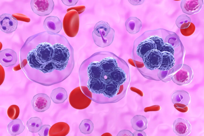 Gânglios aumentados, febre recorrente e suor noturno intenso são alguns sinais que podem estar relacionados ao linfoma e merecem atenção (Imagem: Nemes Laszlo | Shutterstock) - (crédito: EdiCase) Gânglios aumentados, febre recorrente e suor noturno intenso são alguns sinais que podem estar relacionados ao linfoma e merecem atenção (Imagem: Nemes Laszlo | Shutterstock) - (crédito: EdiCase)