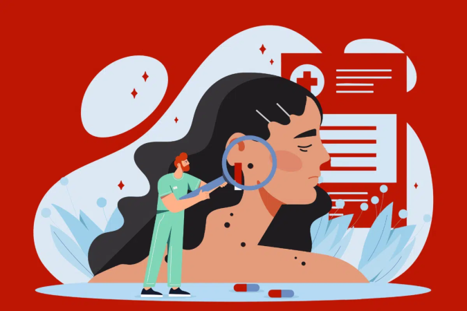 Exposição solar acumulada, histórico familiar e características individuais podem aumentar as chances de desenvolver a doença (Imagem: mentalmind | Shutterstock) - (crédito: EdiCase) Exposição solar acumulada, histórico familiar e características individuais podem aumentar as chances de desenvolver a doença (Imagem: mentalmind | Shutterstock) - (crédito: EdiCase)