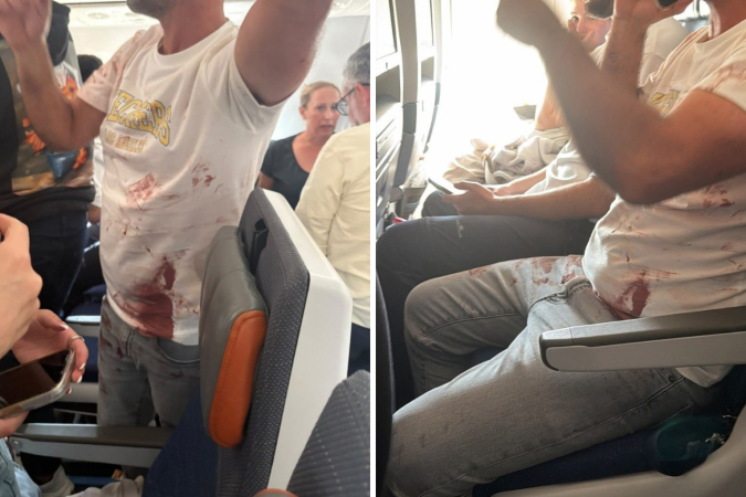 Durante a disputa na cabine, o copiloto atacou o comandante com uma navalha e tentou fazer a aeronave despenhar-se em pleno voo - (crédito: Reprodução/redes sociais) Durante a disputa na cabine, o copiloto atacou o comandante com uma navalha e tentou fazer a aeronave despenhar-se em pleno voo - (crédito: Reprodução/redes sociais)